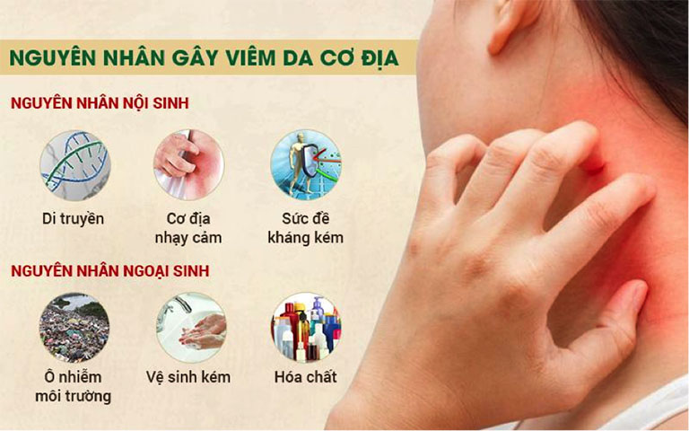 Viêm da cơ địa: Nguyên nhân, triệu chứng và cách phòng ngừa